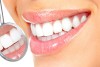 سفید کردن دندان ها در خانه + روش های دارویی و طبیعی